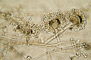 Aspergillus bread mould under a microscope